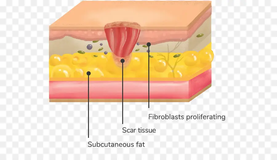 Cicatrice，Tissu PNG