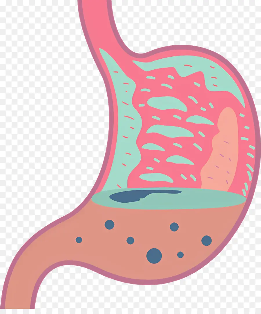 L'estomac，Ulcerès Gastriques PNG