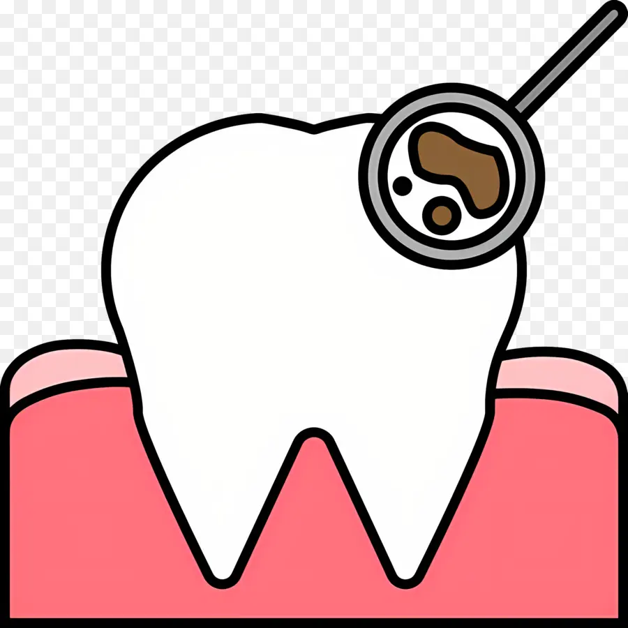 Vérification Des Dents，Dent Avec Carie PNG